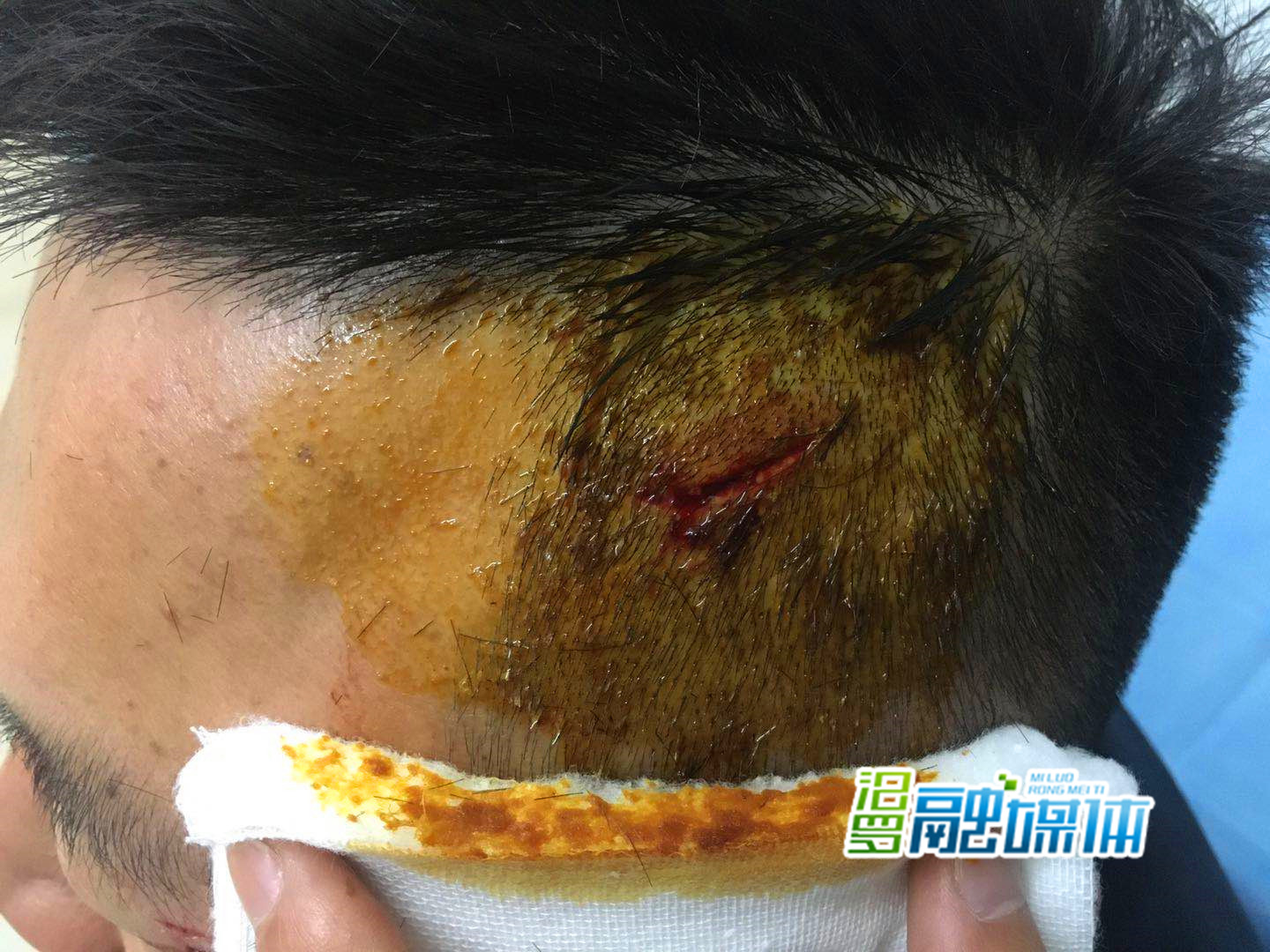 执法人员廖某头部受伤_副本.jpg 执法人员廖某头部受伤_副本.jpg